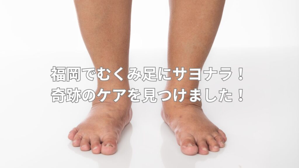 むくんだ足の写真、福岡のむくみ解消ケアの紹介