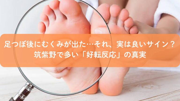足つぼ後にむくみが出た…それ、実は良いサイン？筑紫野で多い「好転反応」の真実